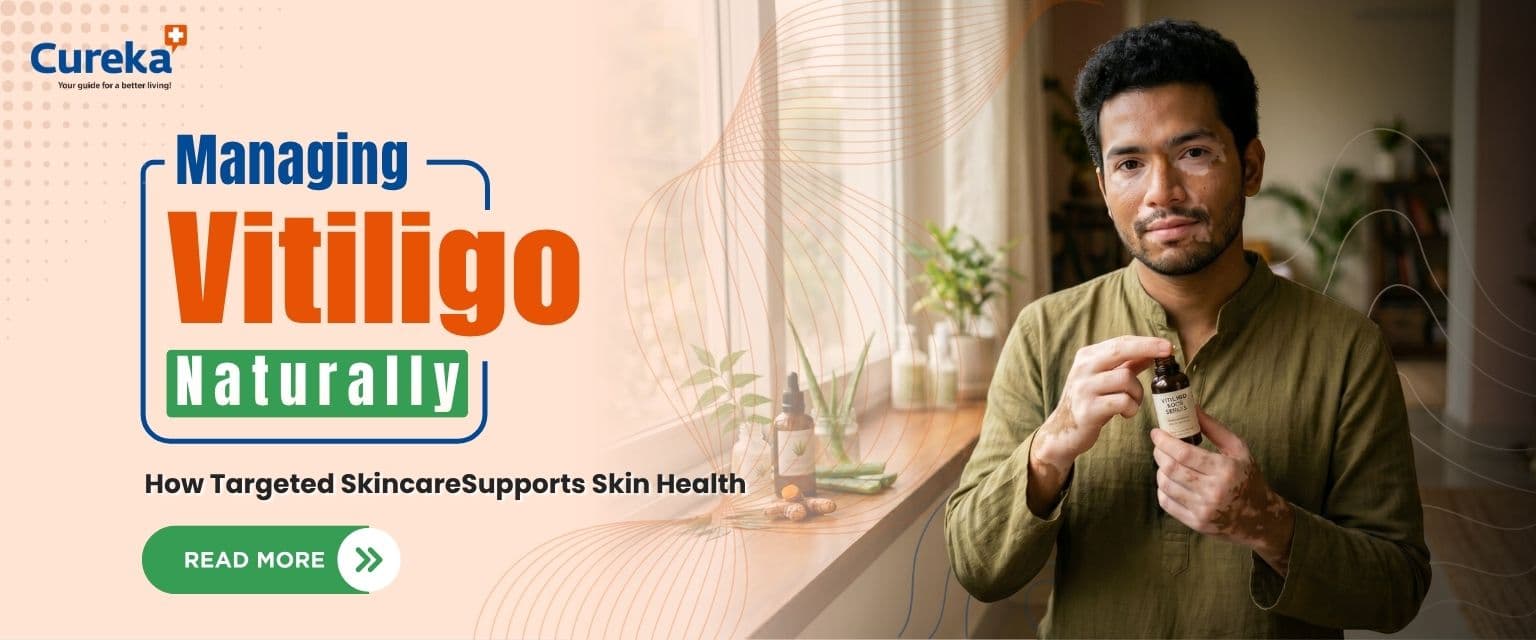 Managing Vitiligo Naturally: How Targeted Skincare Supports Skin Health