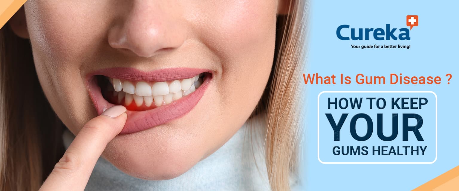 What Is Gum Disease? How to Keep Your Gums Healthy?