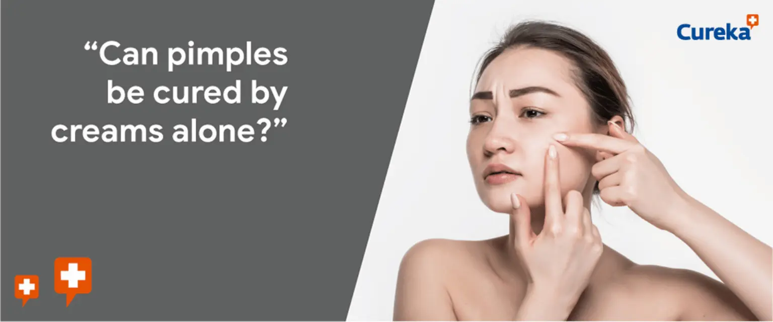 Can Pimples Be Cured By Creams Alone?