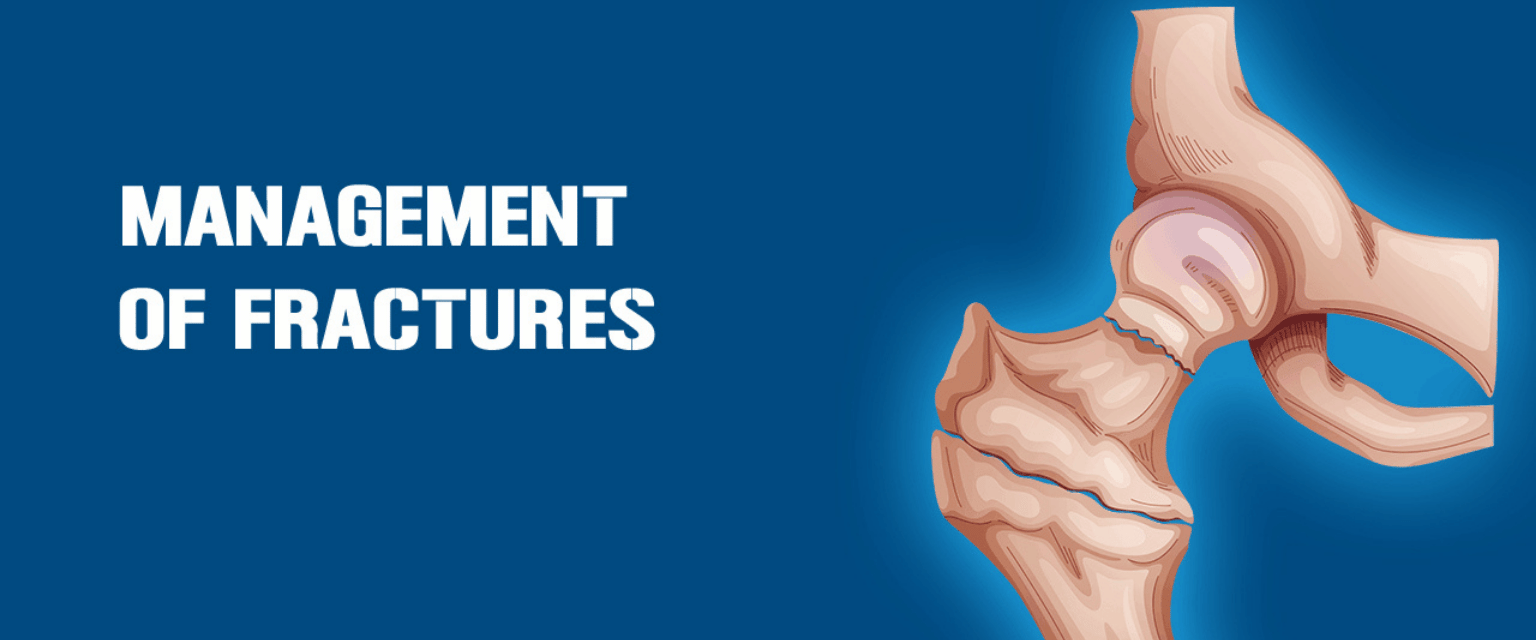 Management of Fractures