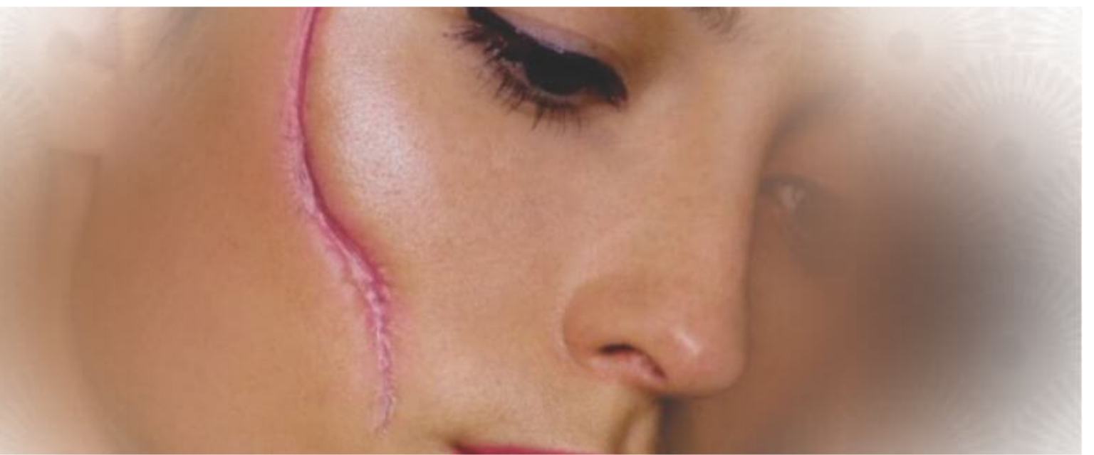Why Scars??