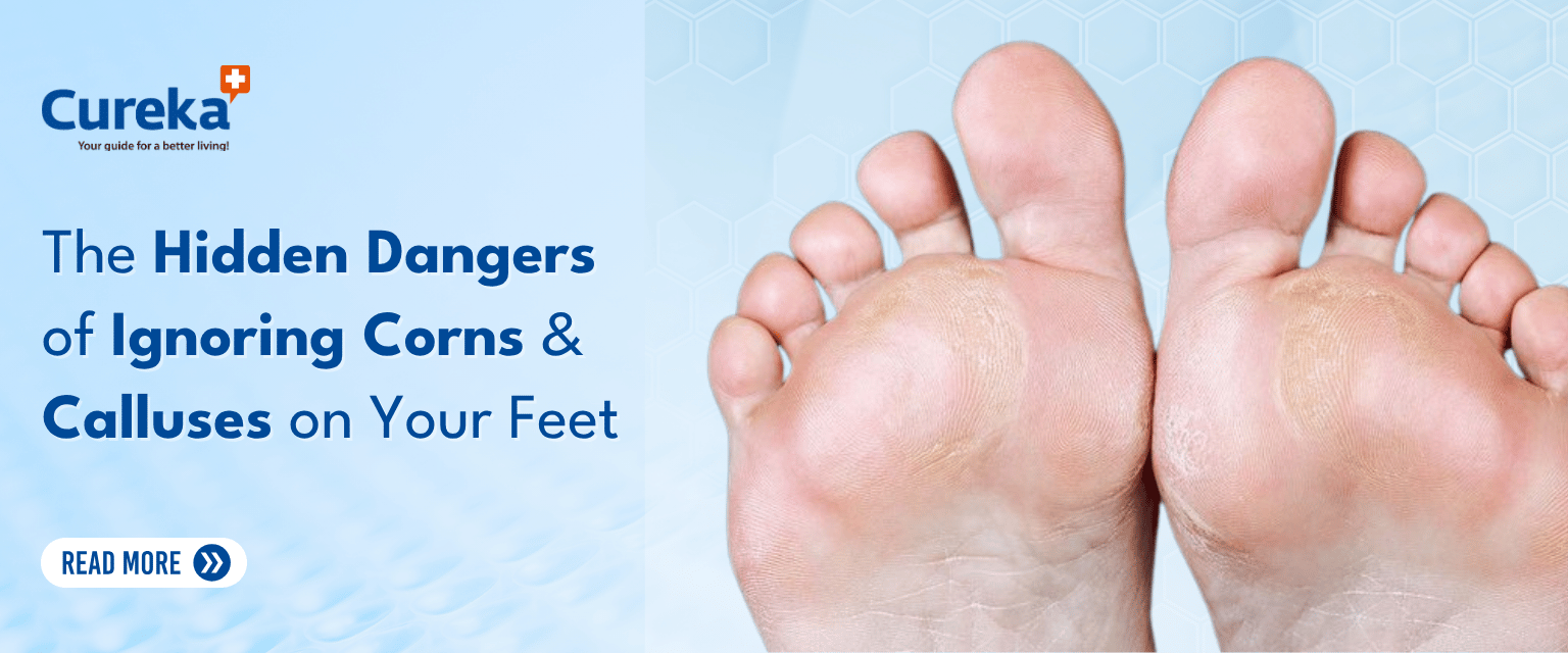 The Hidden Dangers of Ignoring Corns and Calluses on Your Feet