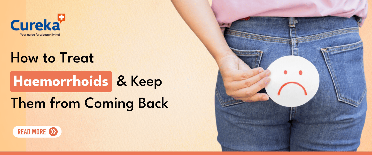 How to Treat Haemorrhoids and Keep Them from Coming Back
