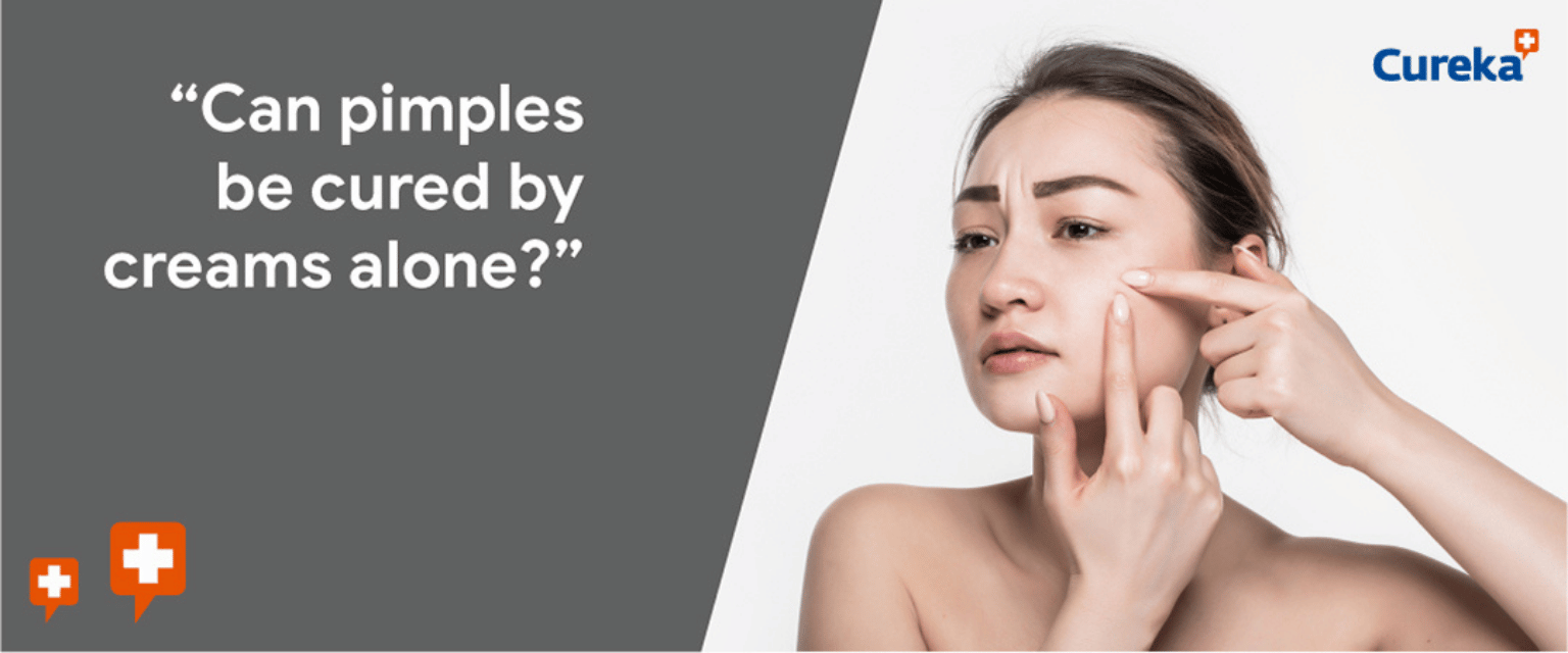 Can Pimples Be Cured By Creams Alone?