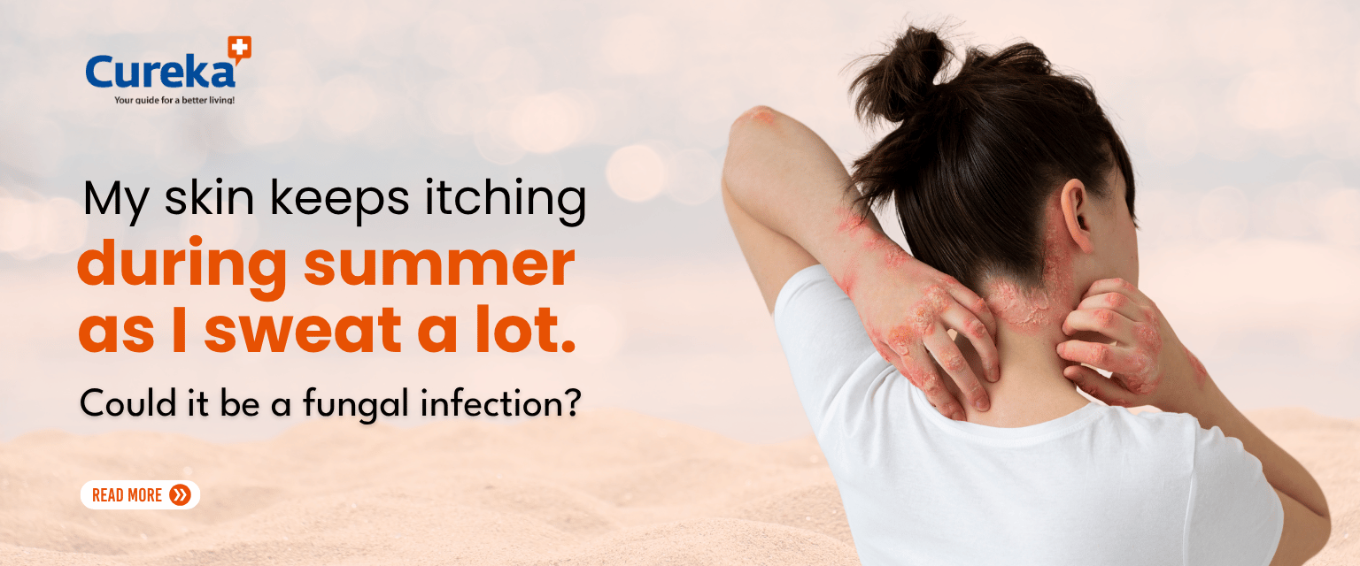 My Skin Keeps Itching During Summer as I Sweat a Lot. Could It Be a Fungal Infection?
