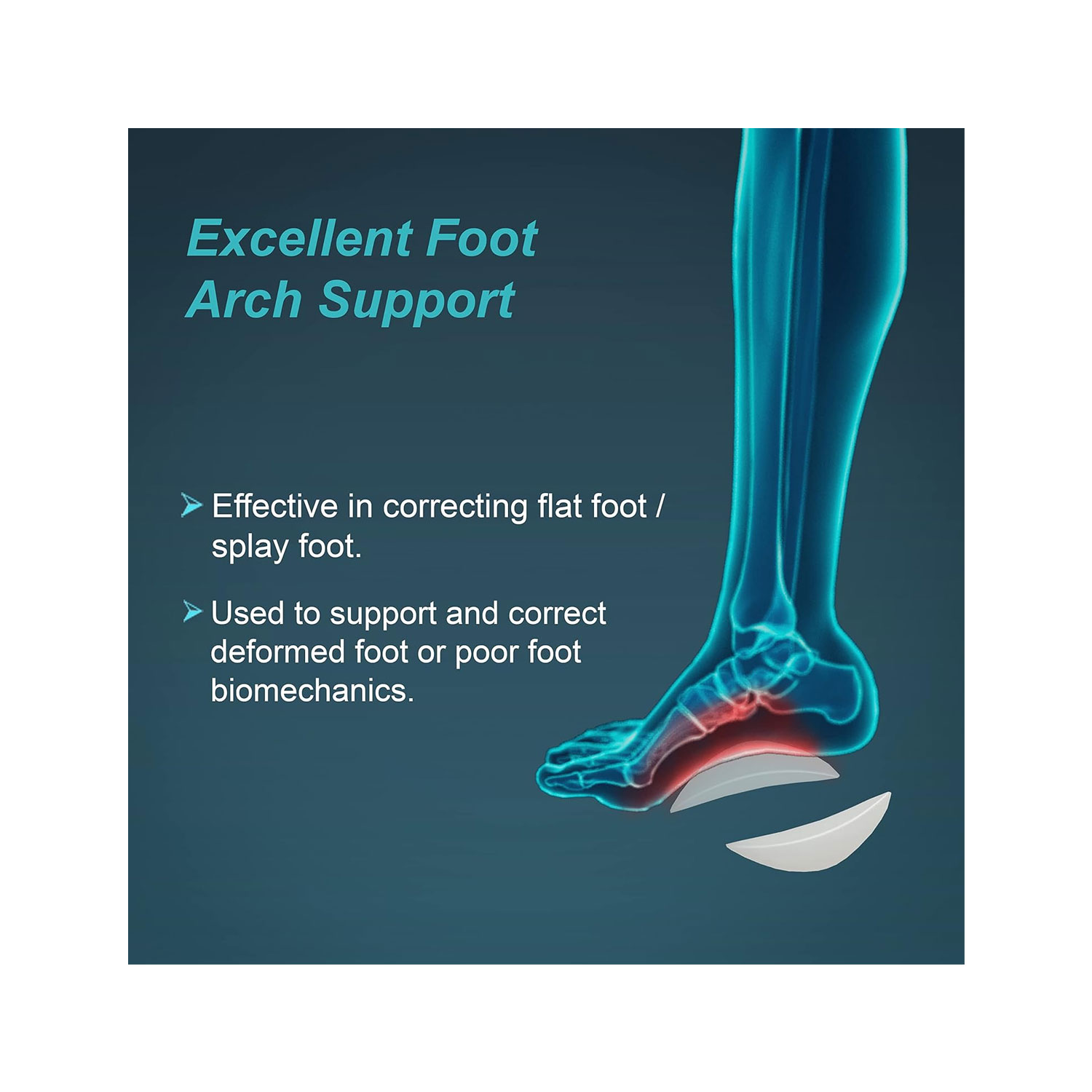 Tynor Arch Support Semi Pro Pair K-15 (Large)