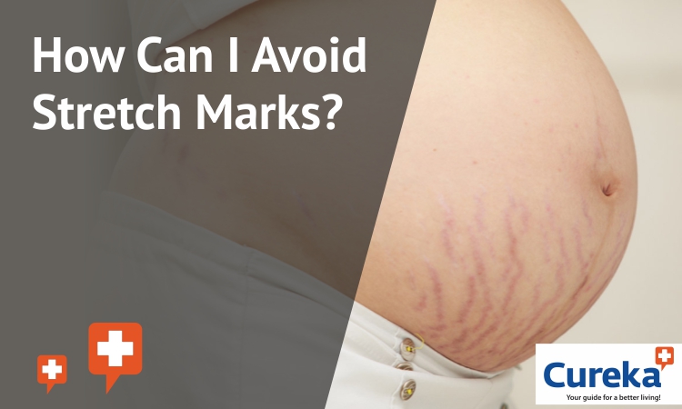 Stretch Mark