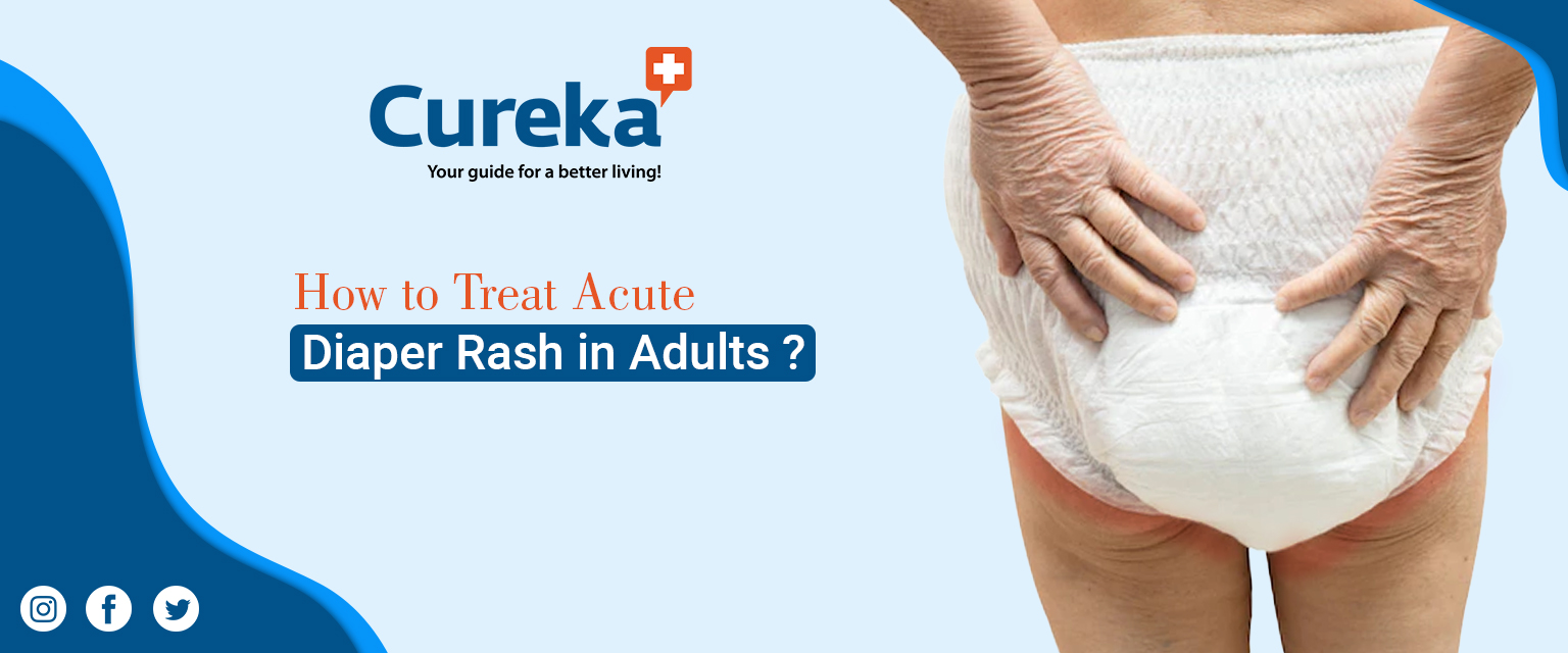 How to Treat Severe Diaper Rash in Adults?