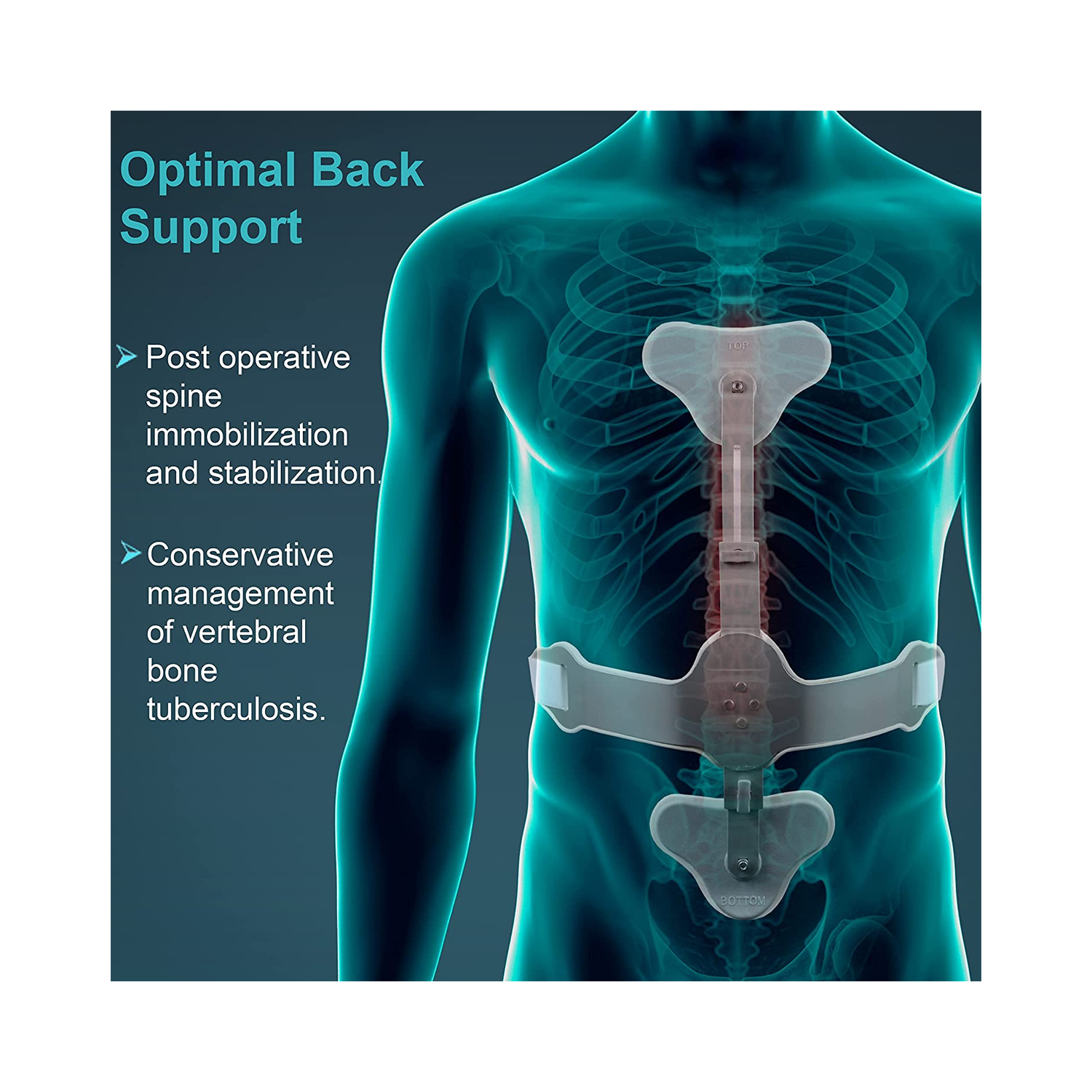 Tynor Ash Brace (Hyper Extension Brace) A12 Large