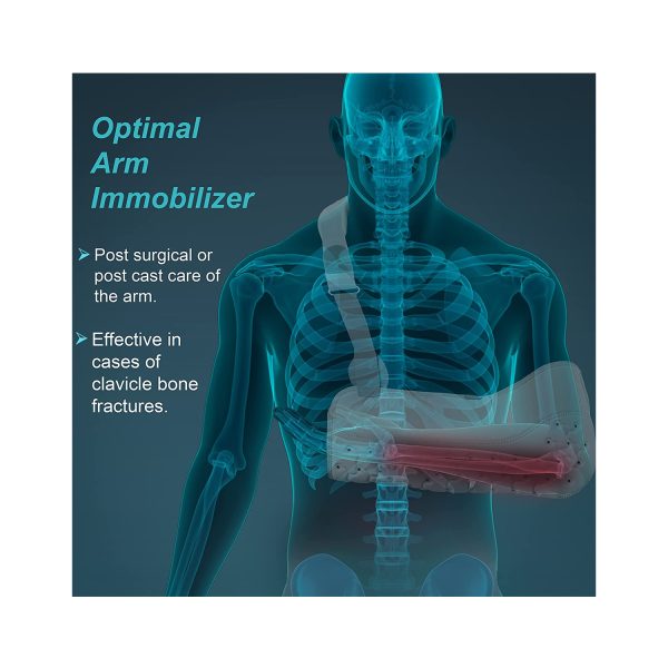 Optimal arm immobilizer