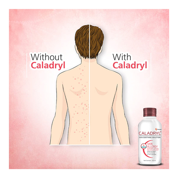 caladryl_skin_soothing_solution_65_ml_2_1