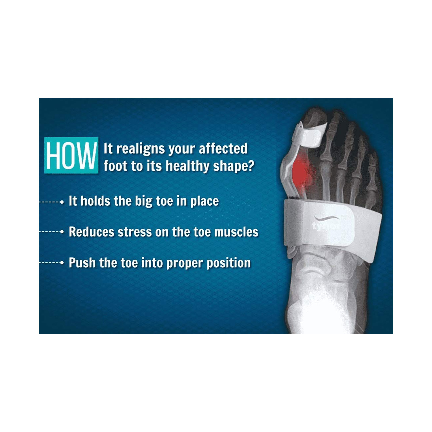 Tynor Bunion Splint K14 (Universal) Cureka Online Health Care