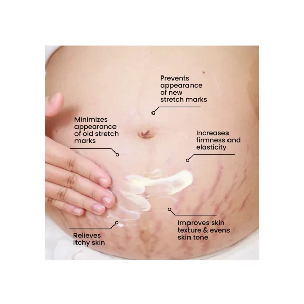 Benefits of ThriveCo Stretch Marks Expert Serum Cream