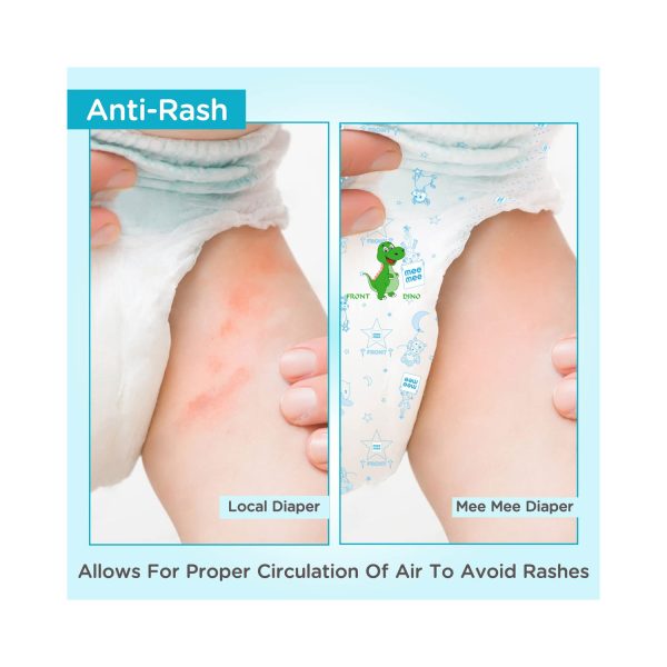 allows proper air circulation to rashes