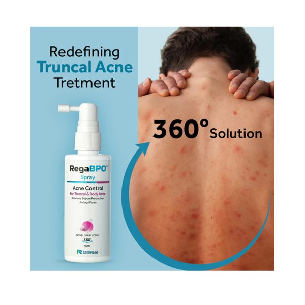 Regaliz RegaBPO Acne Control Spray (60 ml)