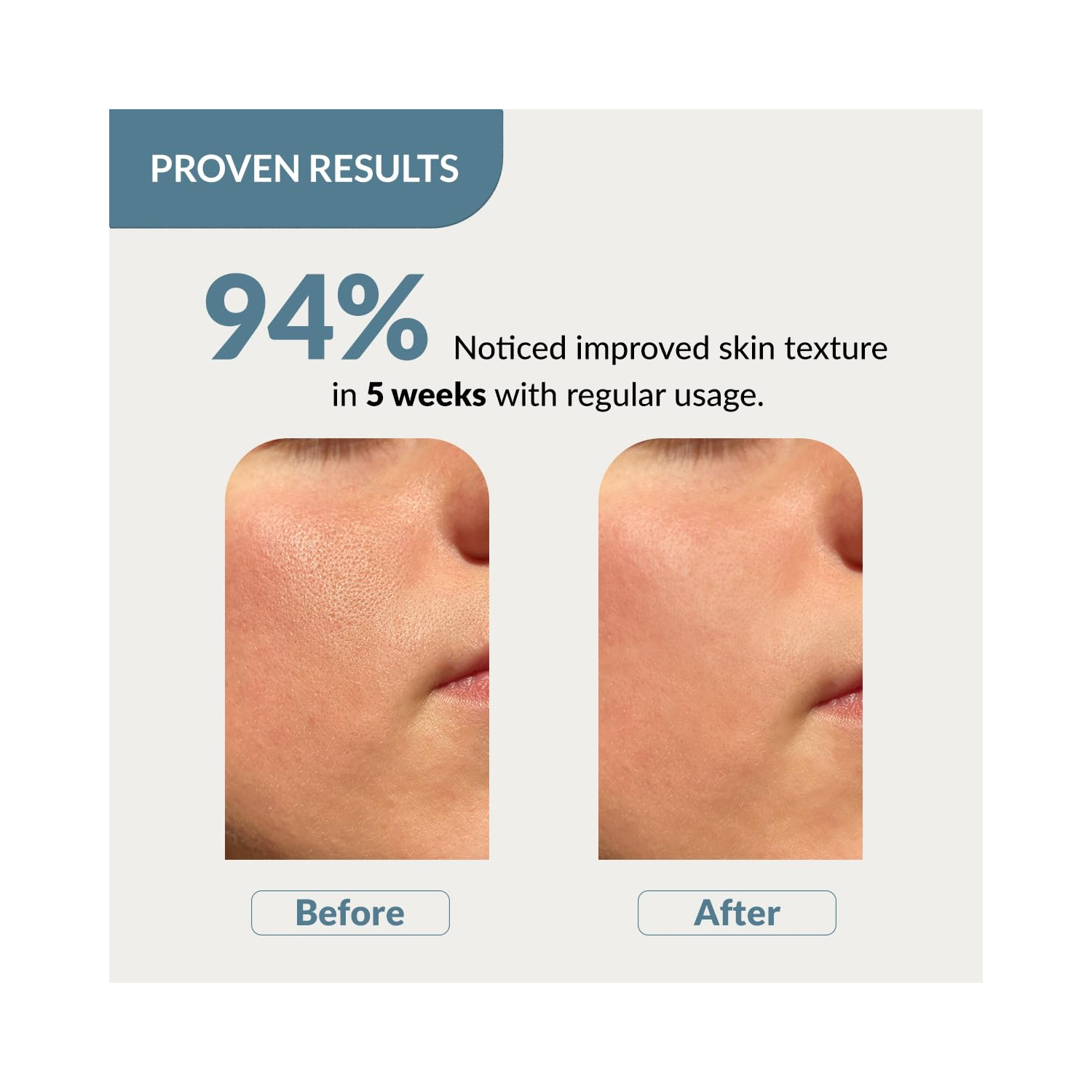 Fixderma-20%-Niacinamide-3