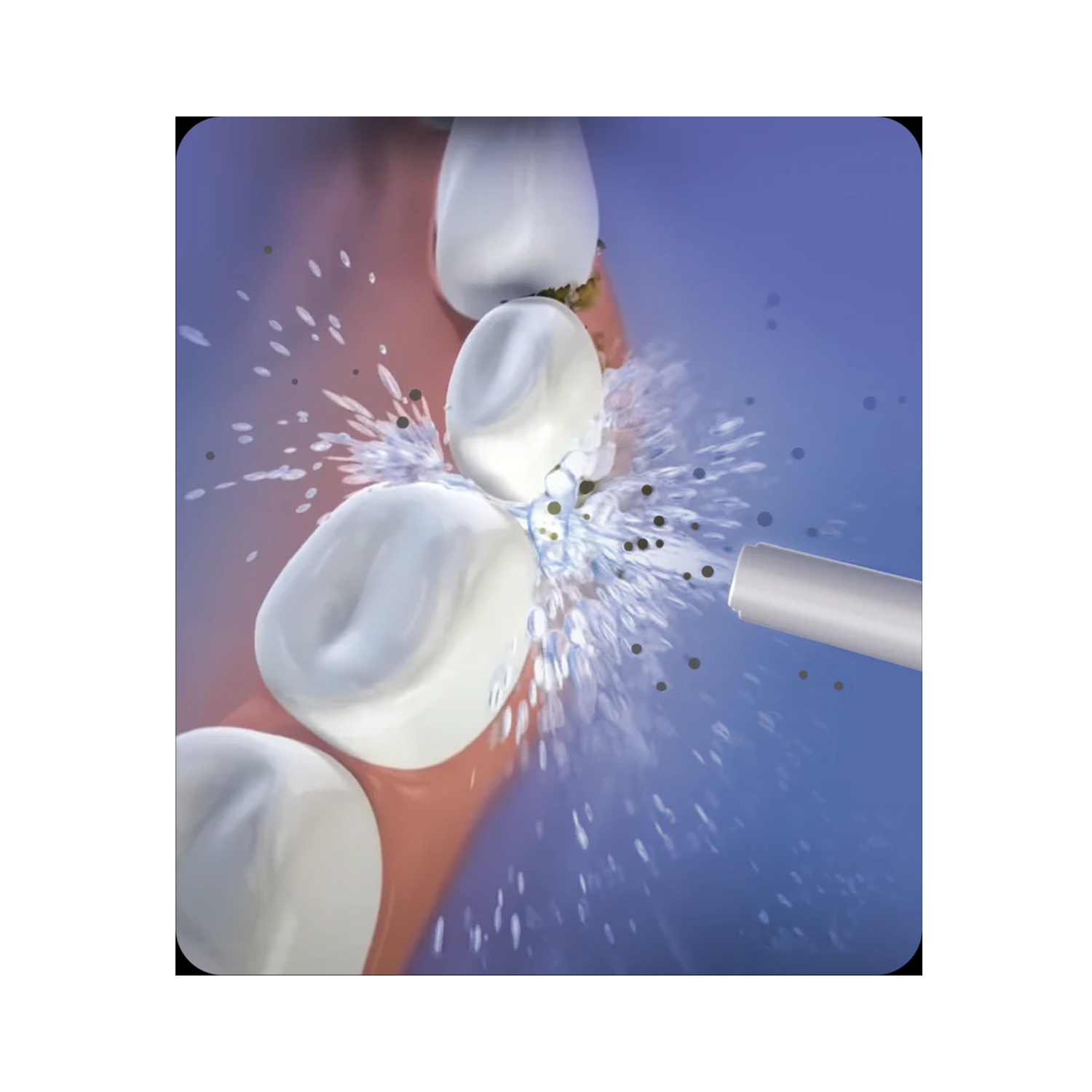 Oracura-Smart-plus-Water-Flosser-OC200–White-3