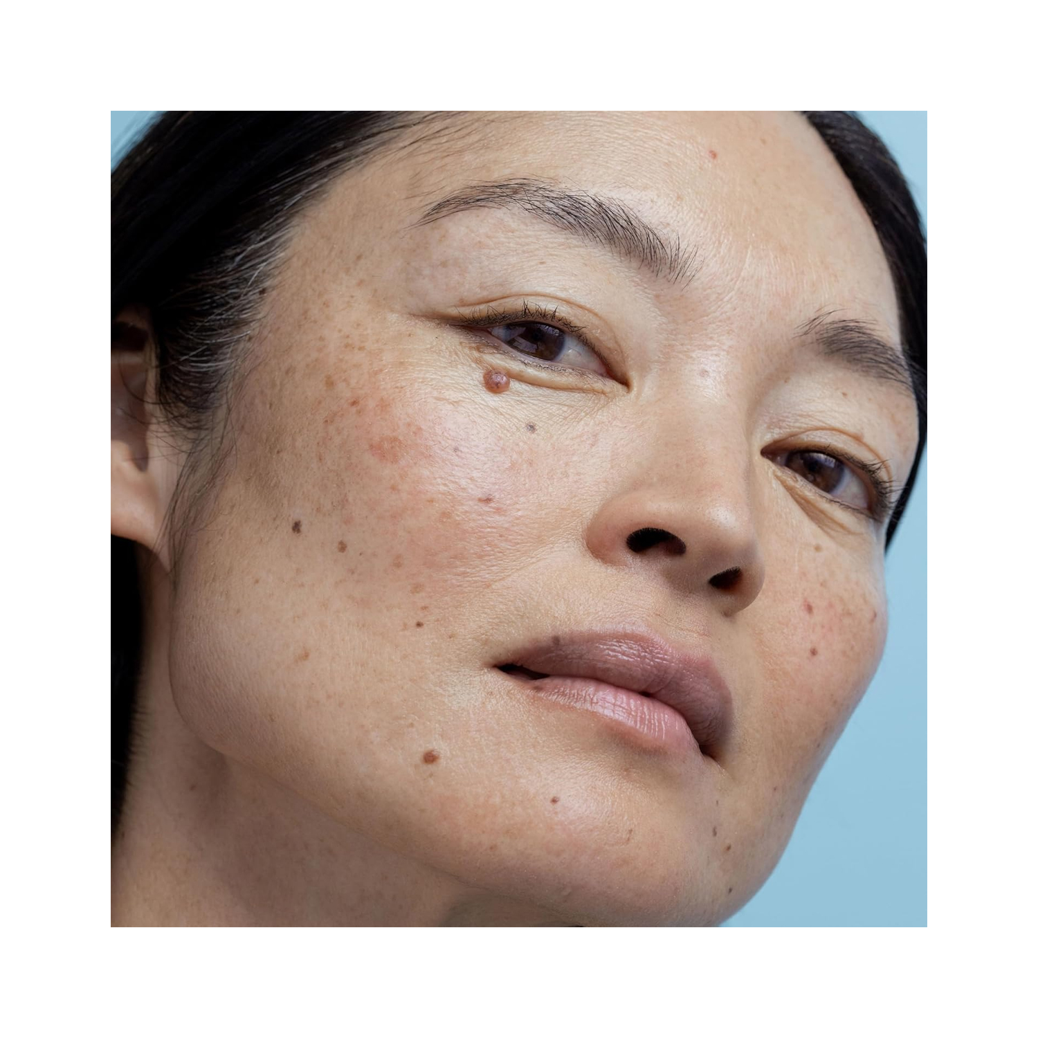 Obagi-Medical-Nu-Derm-5