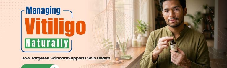 can glutathione help vitiligo Vitiligo main image 0